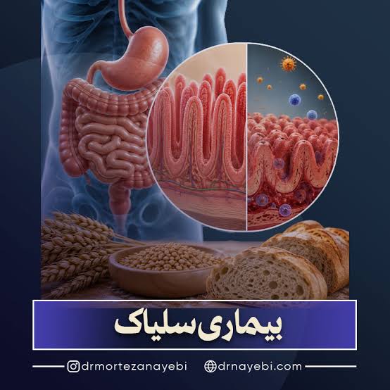تفاوت سلیاک با آلرژی